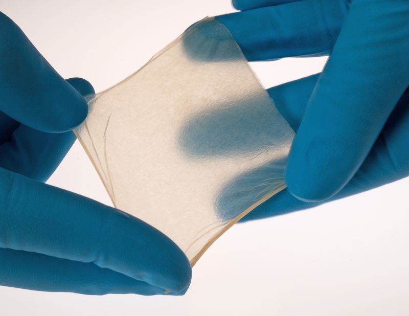 نقش محصولات مشتق از غشای آمنیوتیک در پزشکی بازساختی: معرفی آمنیوسین و آمنیودیسک